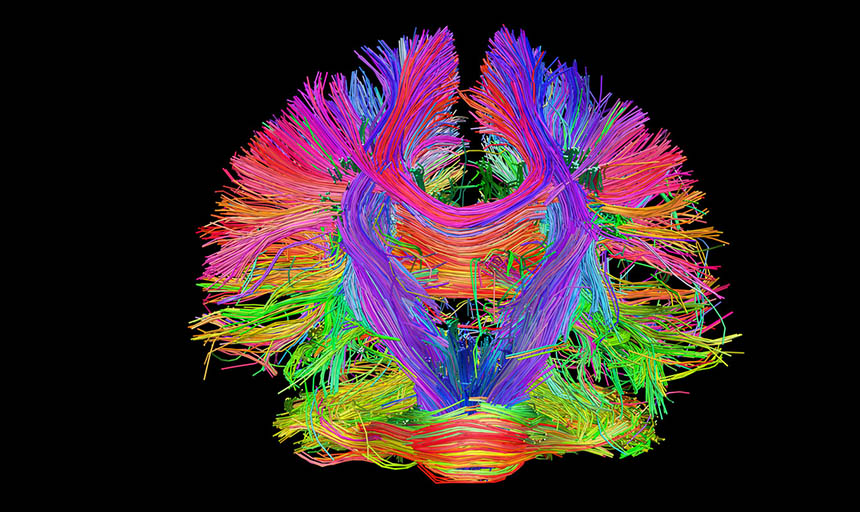 digital representation of a connectome made up of colorful fibers