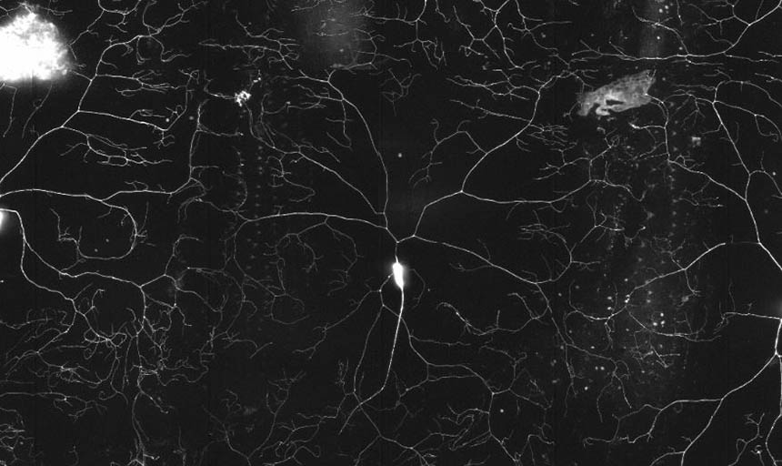 mechanical nociception